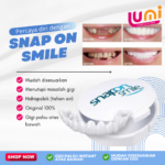 Snap On Smile – YT